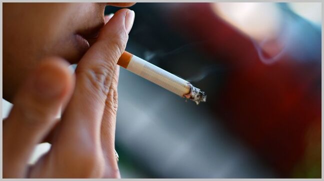 куріння як причина розвитку варикозу
