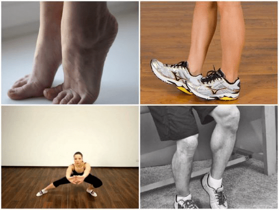 варикоз викликає біль в ногах